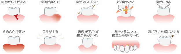 歯周病の症状